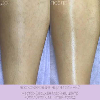 Epilcity, Moscow Фото - 11