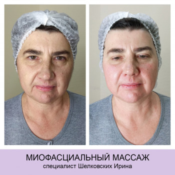 Epilcity, Moscow Фото - 14