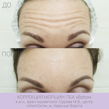 Epilcity, Moscow Фото - 16