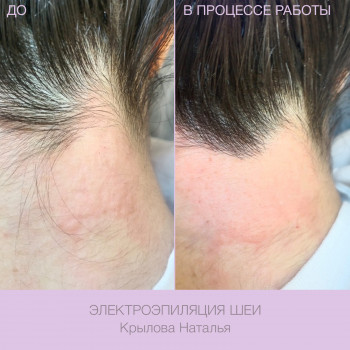 Epilcity, Moscow Фото - 18