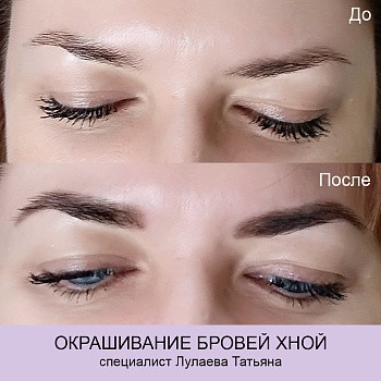 Epilcity, Moscow Фото - 20