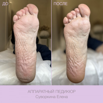 Epilcity, Moscow Фото - 22