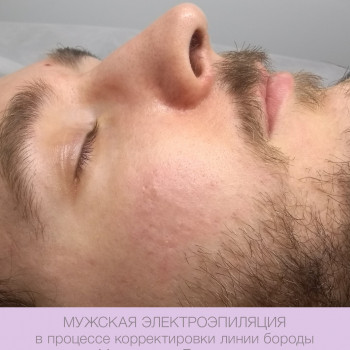 Epilcity, Moscow Фото - 23