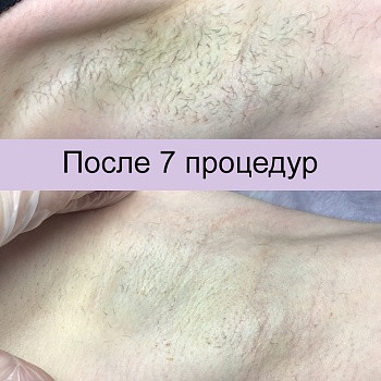 Epilcity, Moscow Фото - 24