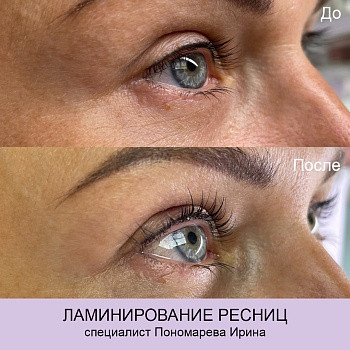 Epilcity, Moscow Фото - 28