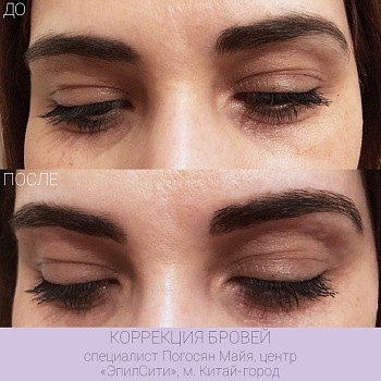 Epilcity, Moscow Фото - 29