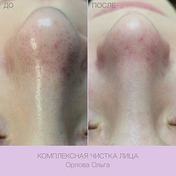 Epilcity, Moscow Фото - 30