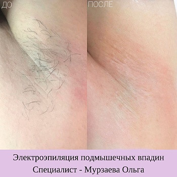 Epilcity, Moscow Фото - 31