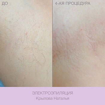 Epilcity, Moscow Фото - 33