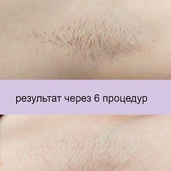 Epilcity, Moscow Фото - 34