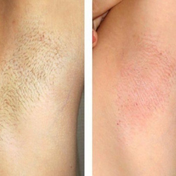 Epilcity, Moscow Фото - 35