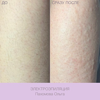 Epilcity, Moscow Фото - 37