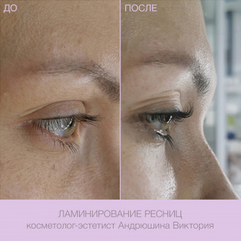 Epilcity, Moscow Фото - 38