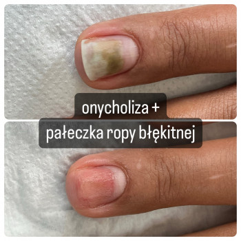 Sportipedes, Warsaw Фото - 5