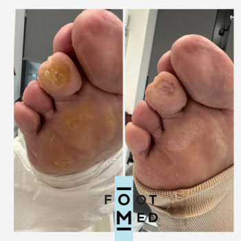 Foot Med, Krakow Фото - 5