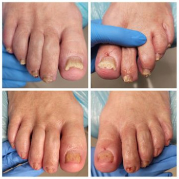 Foot Harmony, Краков Фото - 5