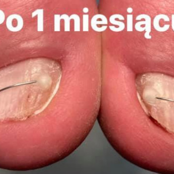 Zdrowe Nogi, Łódź Фото - 5