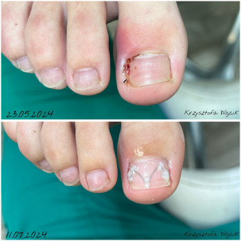 PodoŁódź, Лодзь Фото - 5