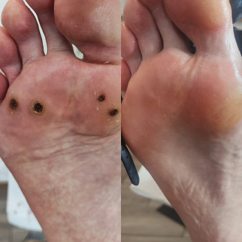 PodoŁódź, Лодзь Фото - 6