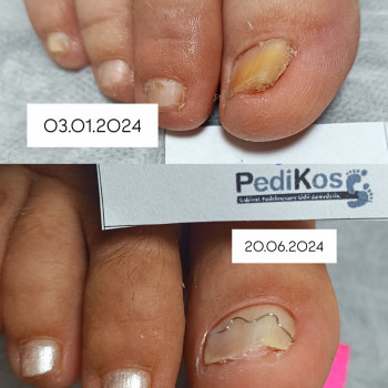 PediKos, Gdańsk Фото - 5