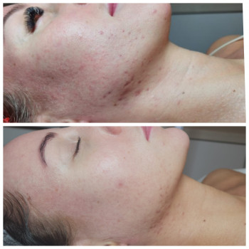 Karolina Grzeszak, Szczecin Фото - 5