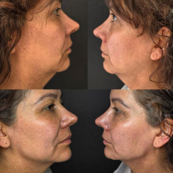 Ann Ilcenko, Szczecin Фото - 5