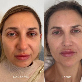 Ann Ilcenko, Szczecin Фото - 6