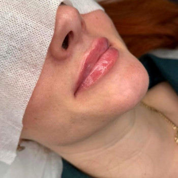 Royal Hanza, Szczecin Фото - 5