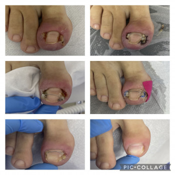 Тарас Семенина, Щецин Фото - 5