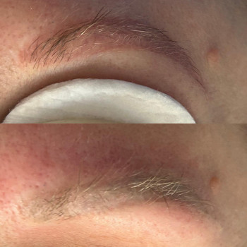 New Skin, Szczecin Фото - 5