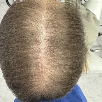 Natalia Lenarczyk, Szczecin Фото - 5