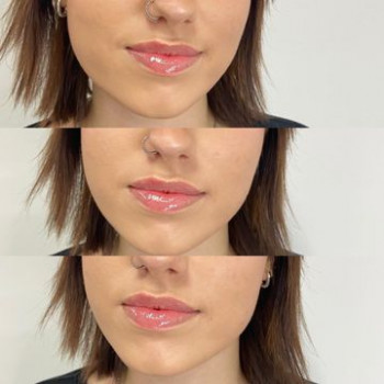 Anna Korbolewska, Szczecin Фото - 5