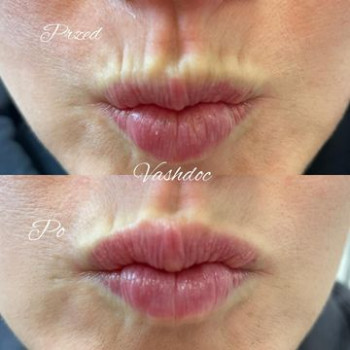 Alina Skorokhod, Szczecin Фото - 5