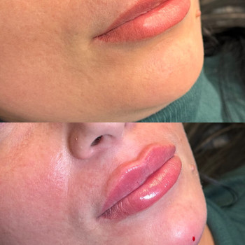 Anzhela Moroshchuk, Warsaw Фото - 42