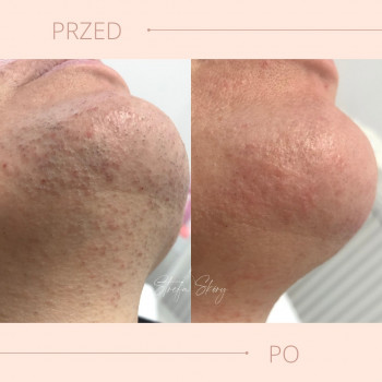 Strefa Skóry, Szczecin Фото - 5