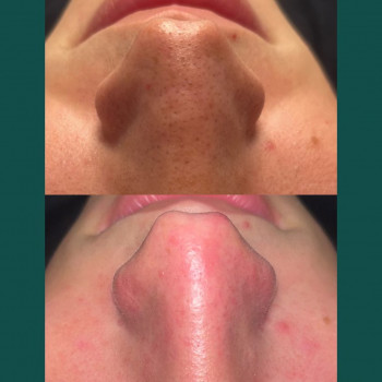 Паулина Ольшова, Щецин Фото - 5