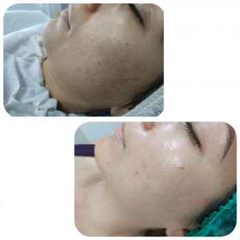 Елена Горская, Netanya Фото - 6