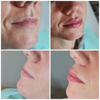 Ева Дзекан, Щецин Фото - 5