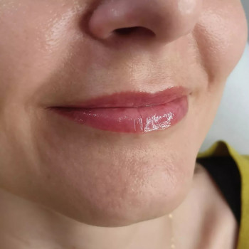 Edyta Tyrkała, Szczecin Фото - 5