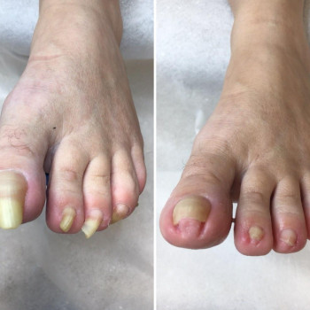 Ale Stopy!, Szczecin Фото - 5