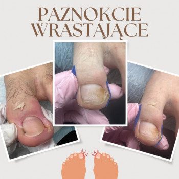 Zdrowej Stopy, Szczecin Фото - 5