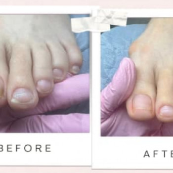 Zdrowej Stopy, Szczecin Фото - 6