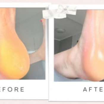 Zdrowej Stopy, Szczecin Фото - 7