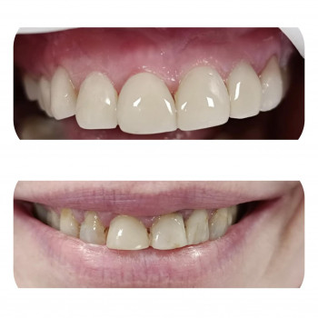 Irmina Galon, Szczecin Фото - 5