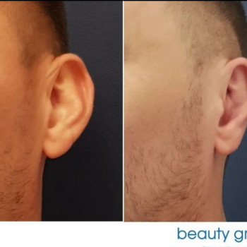 Beauty Group, Щецин Фото - 5