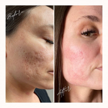 Hubertem Gziut, Szczecin Фото - 5