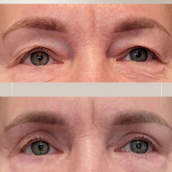 Anna Aseńko, Szczecin Фото - 5