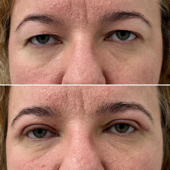 Marcin Wiśniowski, Szczecin Фото - 5