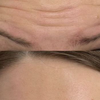 Helen Diachenko, Katowice Фото - 5