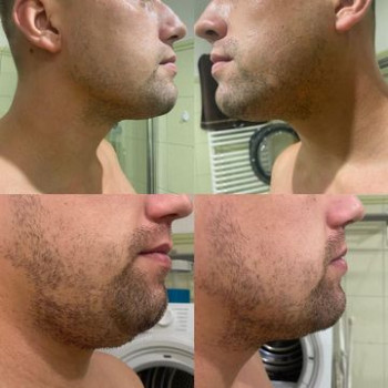 Alla Novitska, Katowice Фото - 5